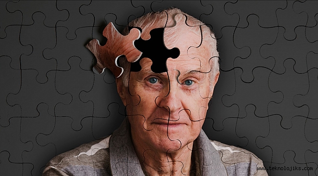Alzheimer düşmanı, hafızayı kuvvetlendiren cihaz geliştirildi – Bilim – Ulusal24